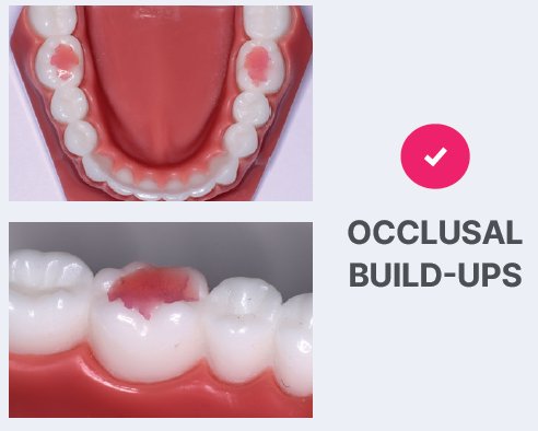 T.K.O. - Composite Bite Turbo Gel Pink