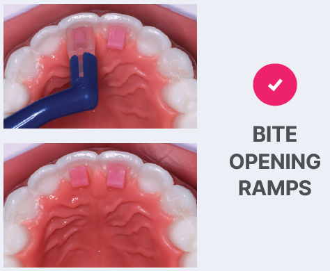 T.K.O. - Composite Bite Turbo Gel Pink