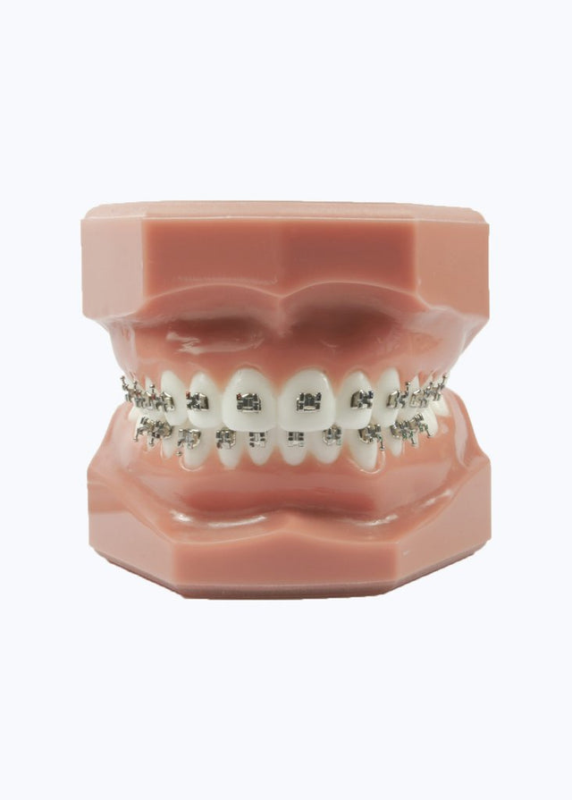 Evolve Orthodontic Metal Brackets
