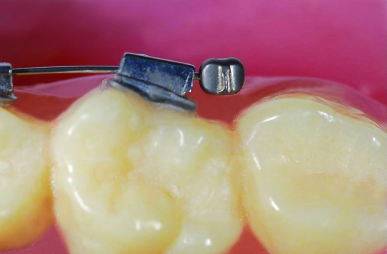 Ixion Safe Cinch Plier