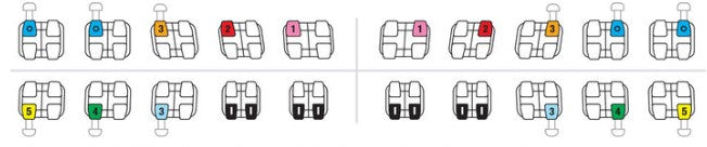 Mini-Sprint II Brackets McLaughlin Bennett 5.0