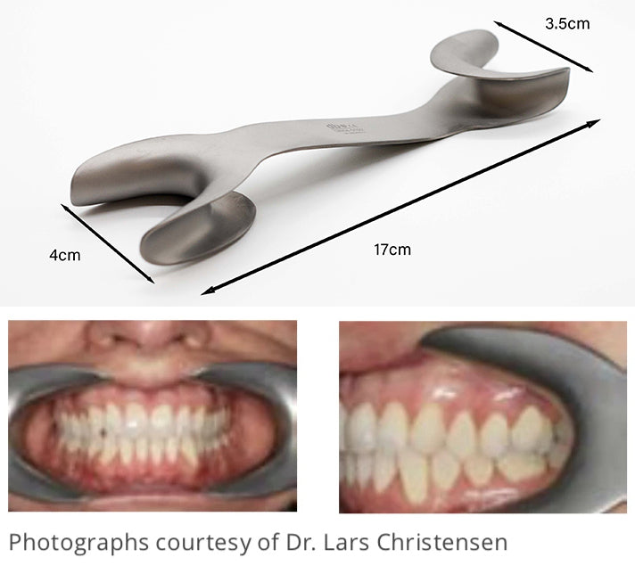 Stainless Steel Cheek Retractor