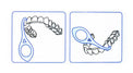 How to use aligner removal tool