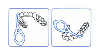 How to use aligner removal tool