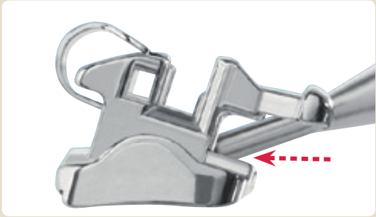 BioQuick Self-ligating Brackets