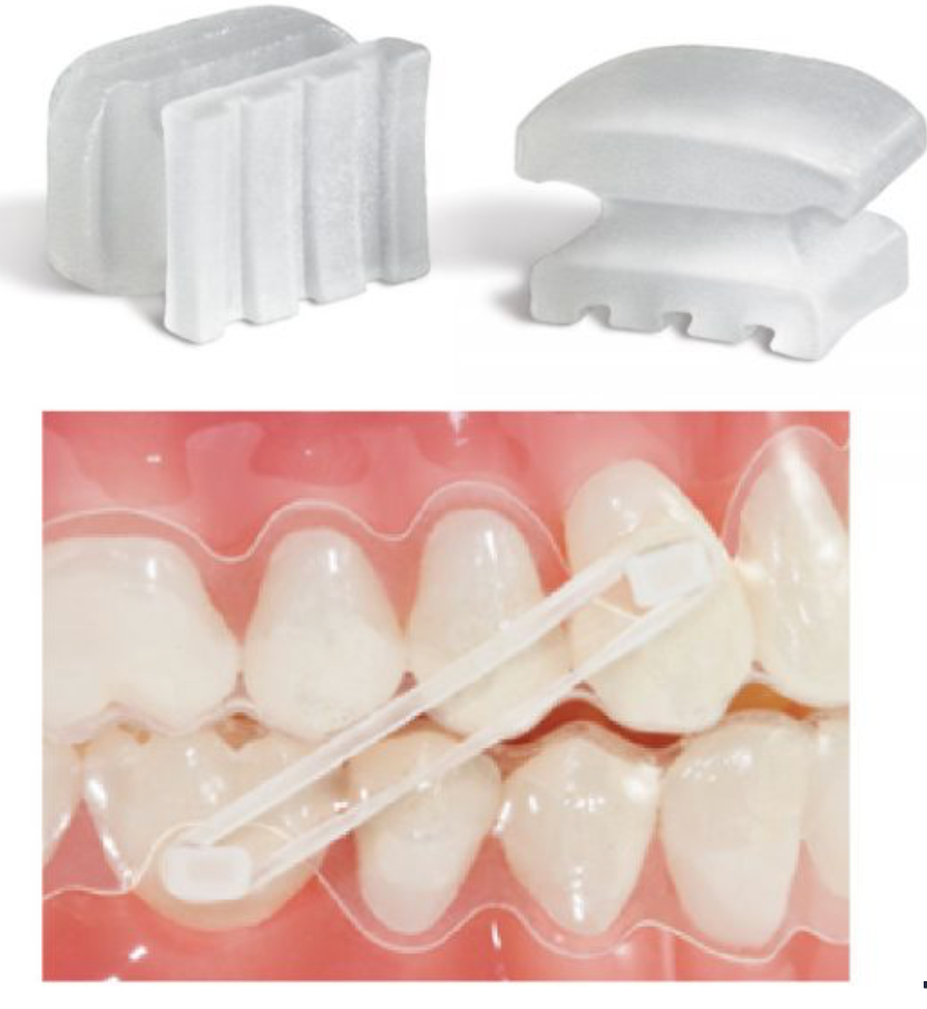 Rectangular Ceramic Buttons - Orthodontic Supplies Australia