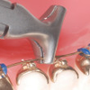 Ixion Intra Oral Detailing Plier 0.5mm