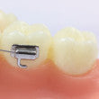Ixion Flush Cut Distal End Cutter
